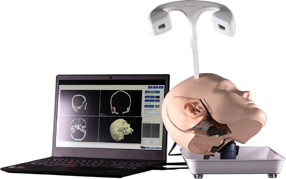 实时显示冠状位、矢状位和水平位CT影像分层显示骨质、神经、肌...